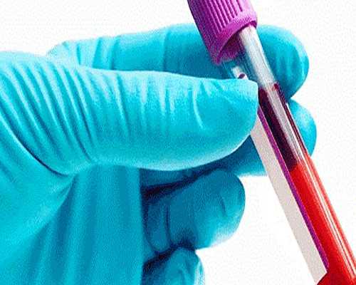 上海借腹生子，紫朵朵为你在线答疑解惑,香港验血男宝准嘛