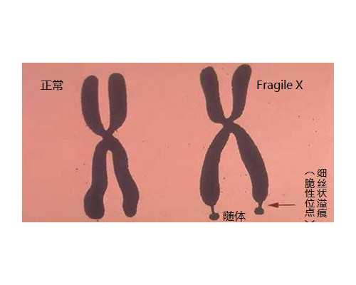 香港验血几周怎么算的，生儿生女自己决定,香港验血哪个医院靠谱