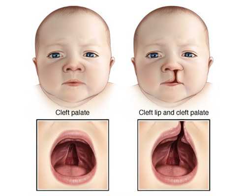卵巢早衰在北京协和做试管成功率高吗？