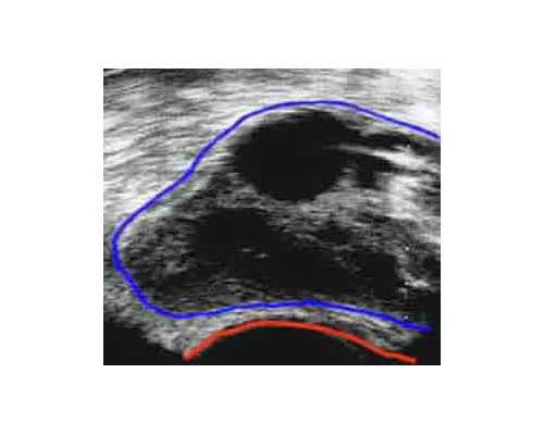 香港验血送检多长时间出结果,香港7周抽血验男女准吗？你想知道的都在这！