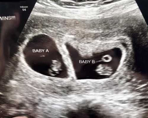 知名供卵试管生子_有谁做过供卵试管,2026年珠海市供卵试管助孕医院排名汇总，