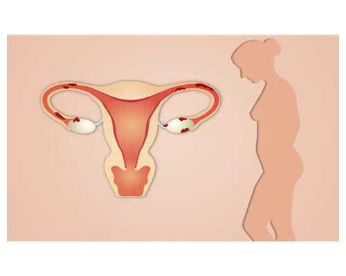 香港验血女还有可能翻盘吗,香港验血有哪些机构是正规的
 人流后再次怀孕香港