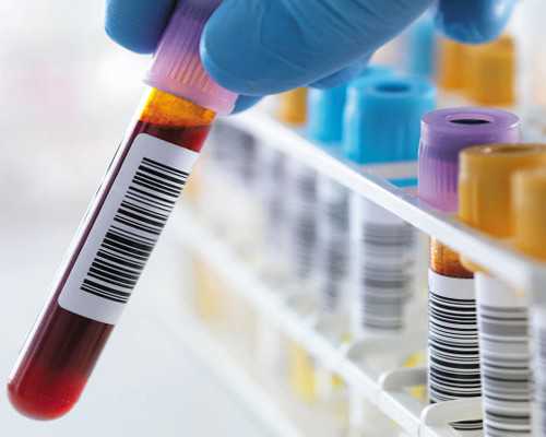 促排取卵后多久可以同房（做了取卵后多久同房）*供卵借卵医院