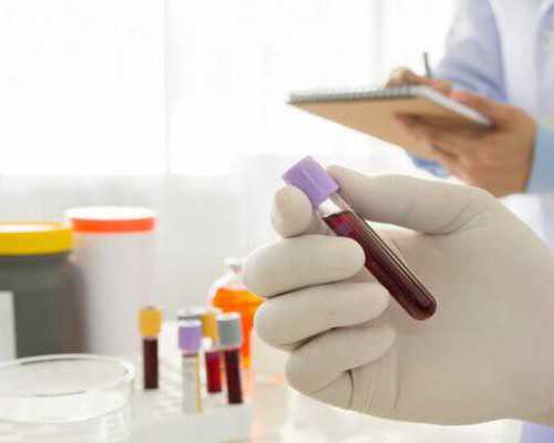 去香港验血要带b超单吗,哪个机构最权威	,香港验血怎么邮寄血液多少钱