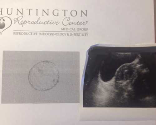 香港验血准还是b超准,自己到香港验血的真实,香港验血一般价格