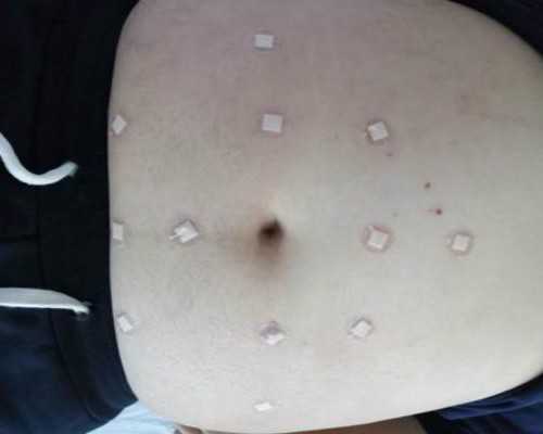 去香港验血要多少钱啊,科学吗时间是多久！,5周可以香港验血吗