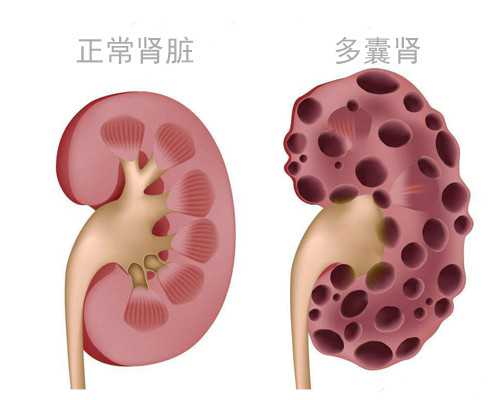 怎么邮寄血液到香港验性别，这边文章整合所有,香港验血空腹会不准吗
