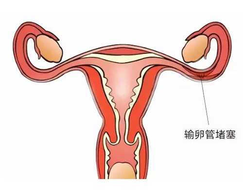 香港验血有名的化验机构,有什么安全的方法可以知道宝宝性别——香港D
