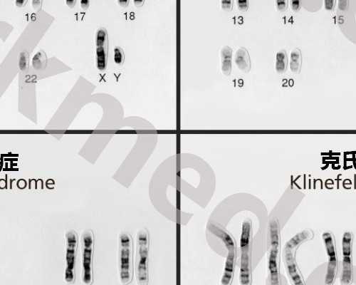 HCG与宫外孕*代生价钱