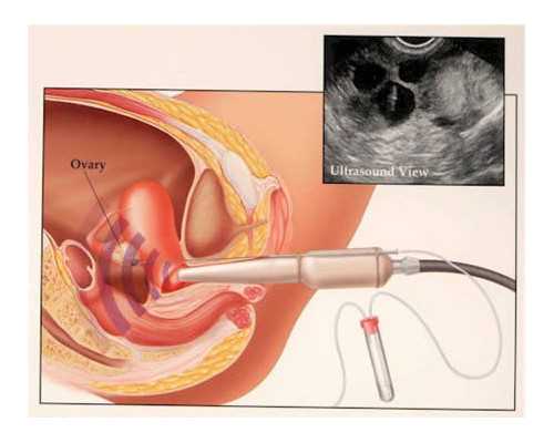 咨询：验血男女机构在哪_快来看看围观过来人都,香港验血要多少个D才是男宝