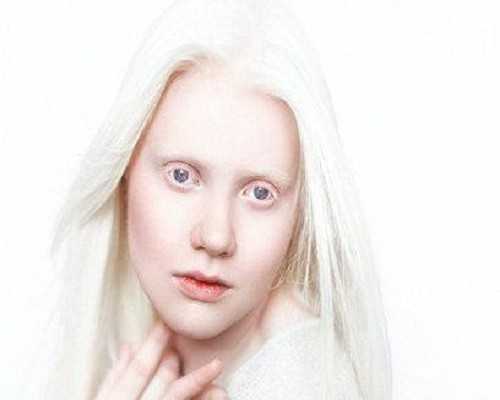 6周香港验血男女准吗？亲身经历分享给大家,香港时代医疗五周可以验血吗