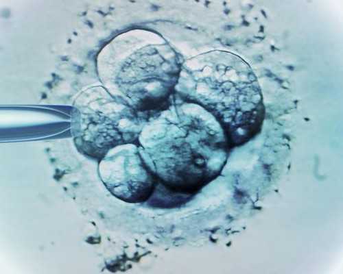 香港胎儿染色体检测多少钱？验血的最全攻略要,哪有香港验血机构