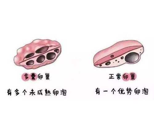 为什么供卵要等半年才能移植,不孕不育治愈概率多少_上海供卵试管医院有哪些