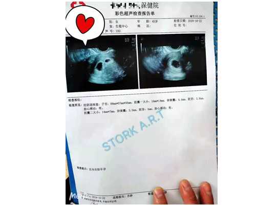 广州一商业机构为男性提供代孕服务被查：可与客户共同生活_大连代孕