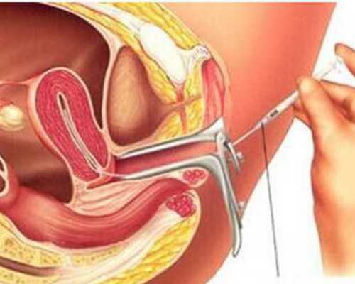 提高北京助孕宝宝抵抗力注意帮北京助孕宝宝补锌
