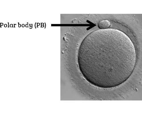 卵泡黄素化排卵试纸怎么显示_卵泡偏小怎么办*试管代孕机构
