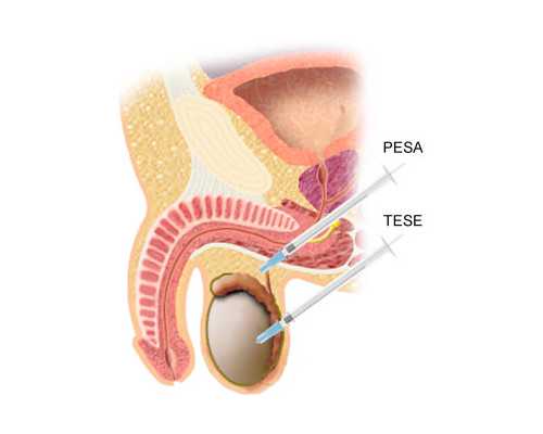 供卵媒体联系方式_医院供卵价格,北京供卵中心|供卵试管费用|供卵试管能怀男