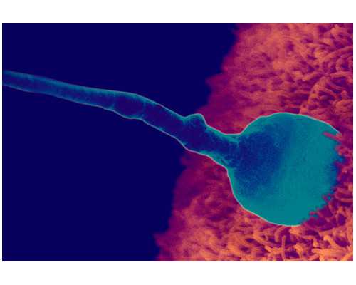 移植后憋尿出血怎么办移植后憋尿出血怎么回事*供卵医院电话