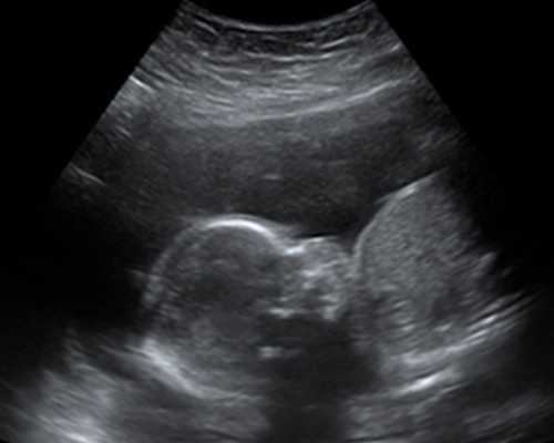 如何带北京助孕宝宝游泳夏季带北京助孕宝宝游泳全攻略