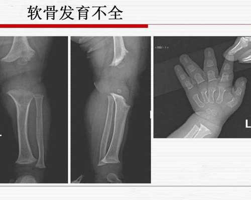 染色体疾病遗传给下一代怎么办（第三代私人代怀性别男孩帮你排查）
