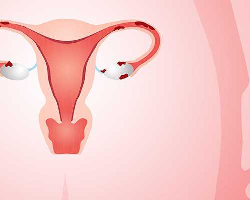 北京助孕宝宝发烧8小妙招