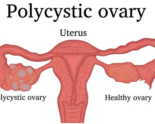 广州一商业机构为男性提供代孕服务被查：可与客户共同生活_私人代孕网