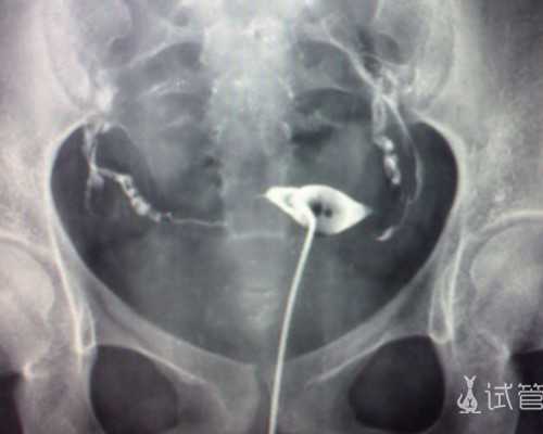 去泰国BNH医院做试管婴儿，住附近哪个酒店?*代生机构咨询