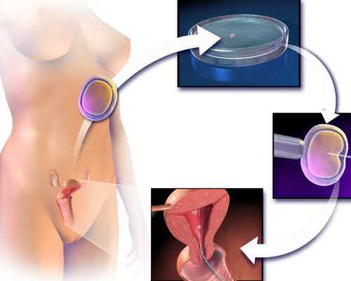 香港测男女多少钱_找权威化验所来帮你很关键,怀孕一个多月香港验血要多少钱