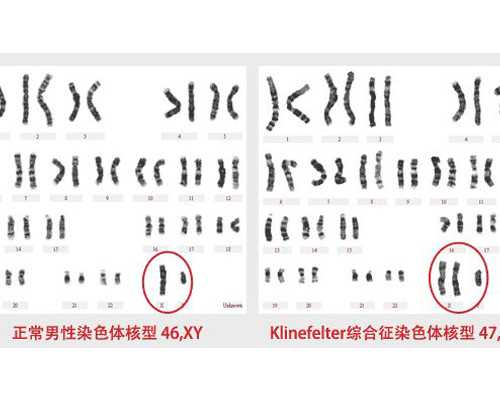 有香港验血男宝翻盘的吗,香港验血怎么约中介
 怀孕6周去香港验血要超过几个