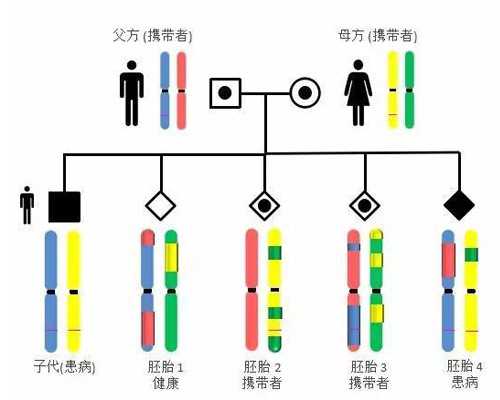 孕成国际：试管婴儿助孕前应该进行什么检查？_大连代孕-代孕公司在哪里