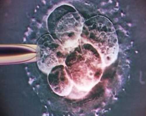 北京家圆医院借卵生男孩费用3-9万元不等?-宁波代孕-怎么找靠谱代孕网