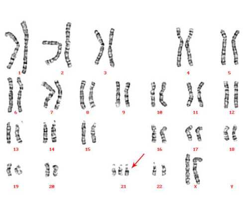 有这些子宫问题，做试管婴儿的成功率高吗