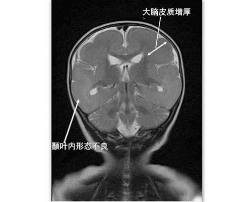 台湾试管婴儿成功率台湾试管成功率是不是比内地高,试管代怀宝宝